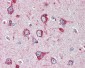 MNSOD / SOD2 Antibody